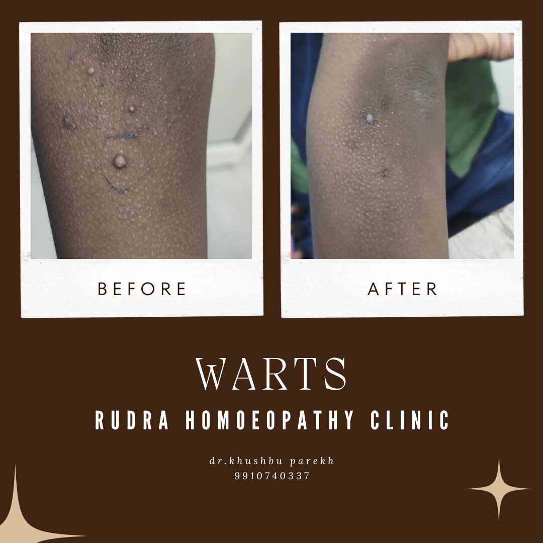 Before After Beauty Skincare Minimlasit Instagram Post