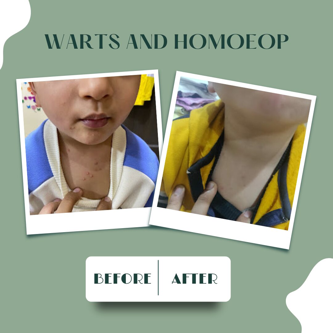 Free post comparison before and after beauty