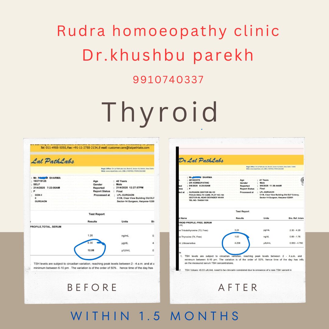 Neutral Modern Before and After Progress Instagram Post