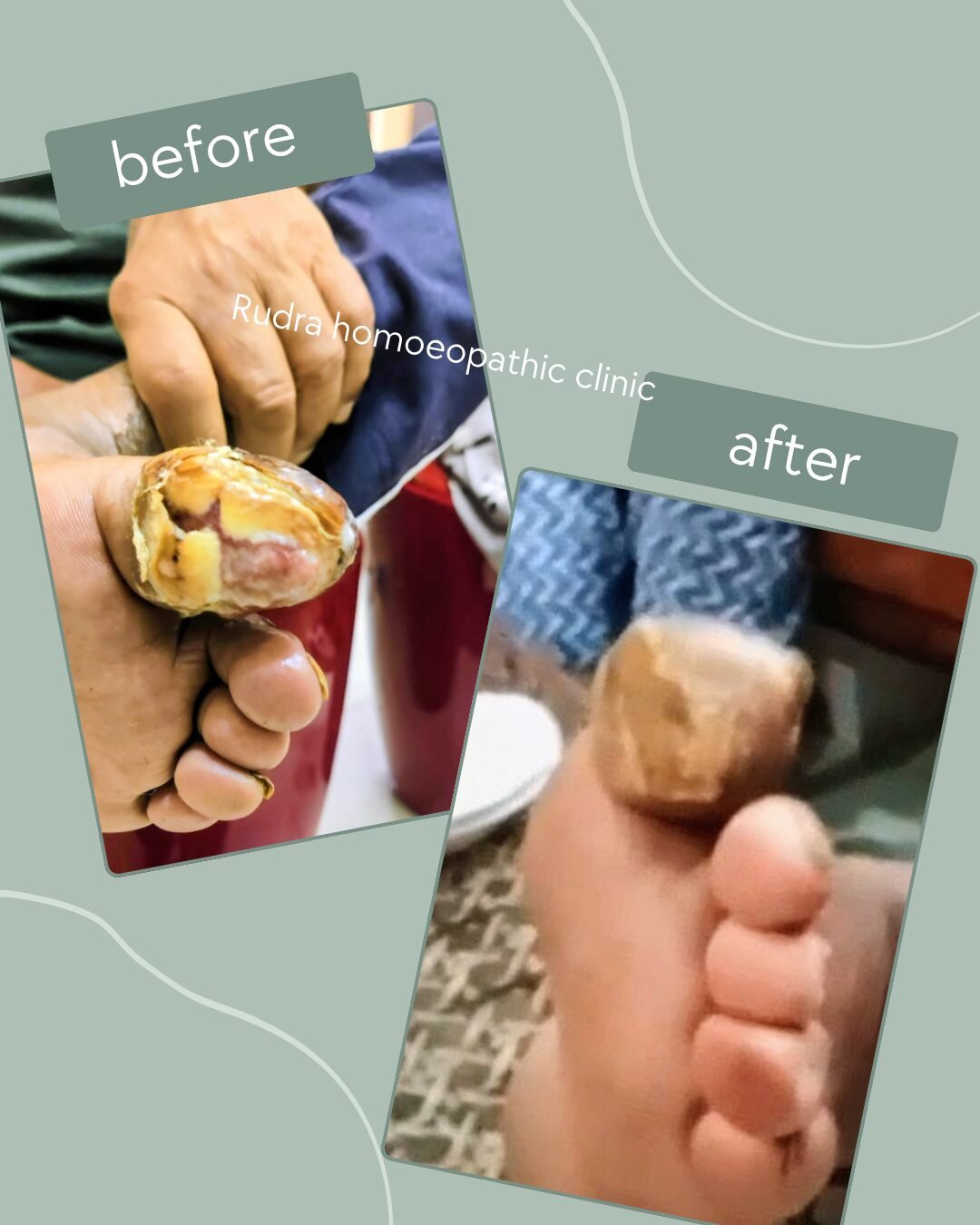 Green Minimalist Before After Fashion Style Instagram Post_20260615_120839_0000