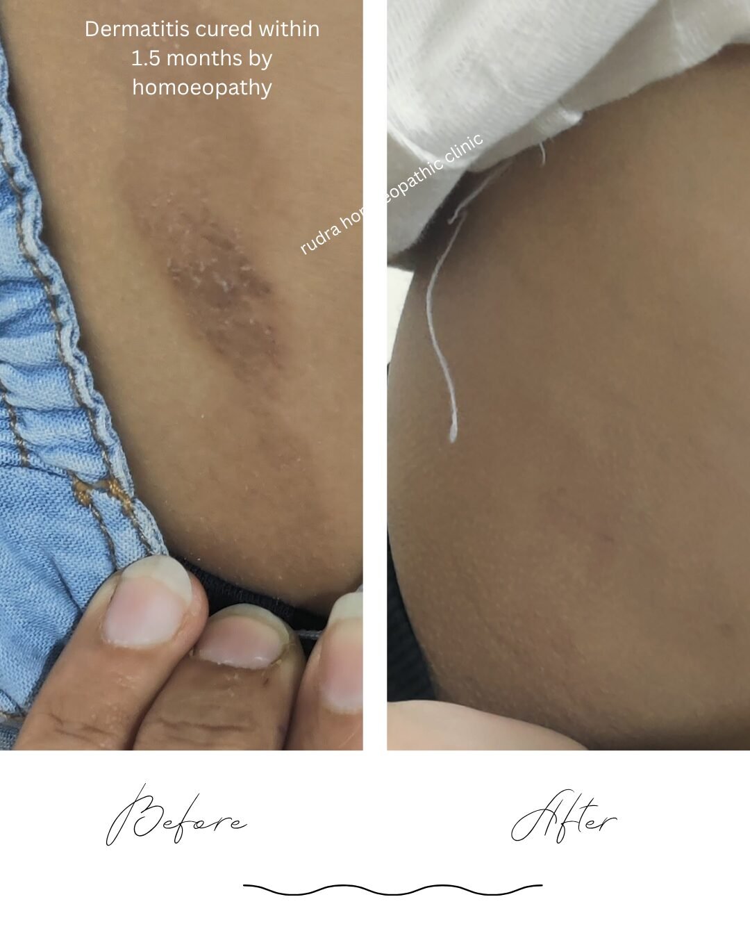 Neutral Minimalist Skincare Before and After Instagram Post_20260615_113210_0000 - Copy